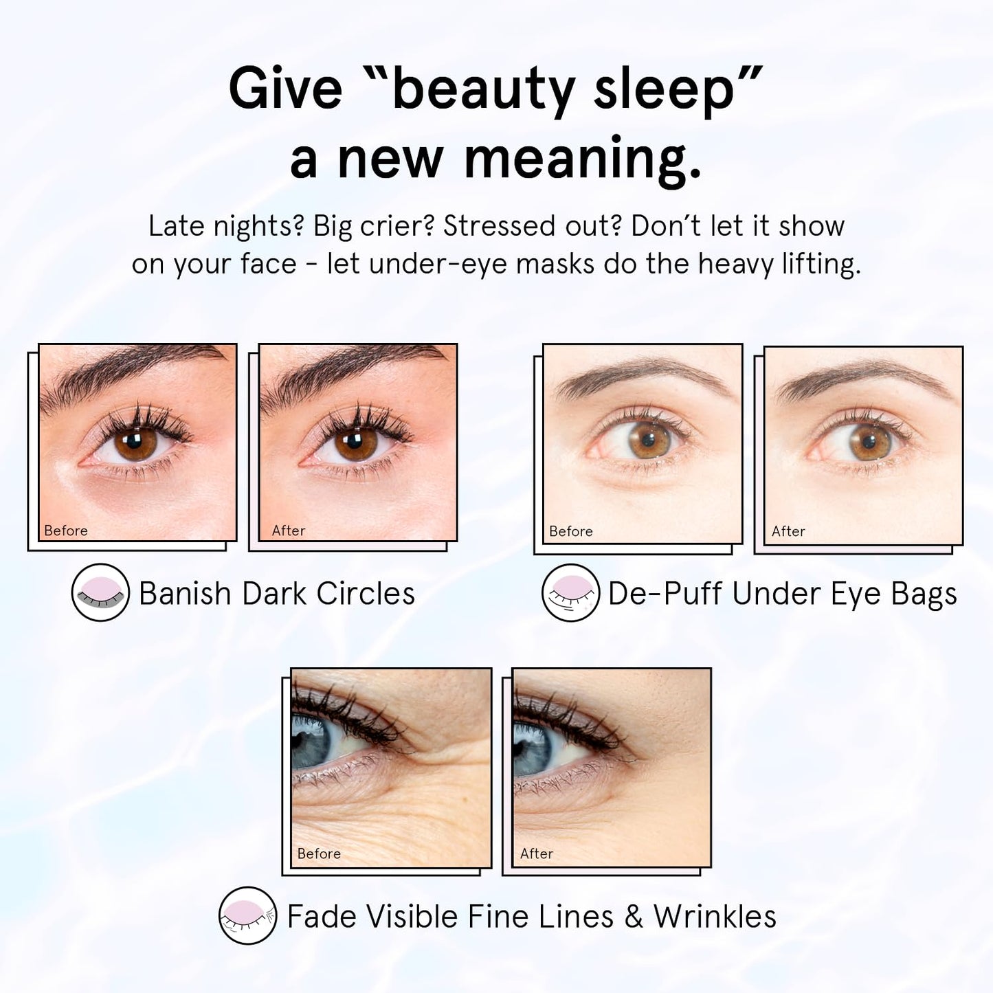 Under Eye Gel Patches for Puffy Eyes and Dark Circles – 24 Vegan Pads with Retinol and Hyaluronic Acid – Skincare Gift for Women